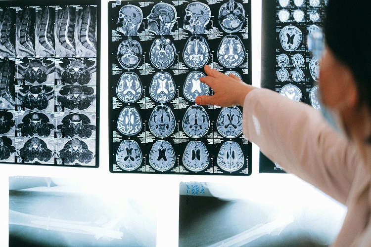 neuro